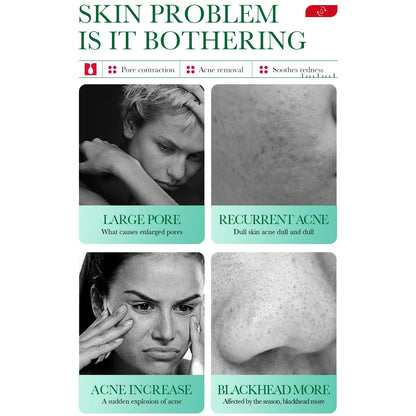 Salicylic Acid Acne Set
